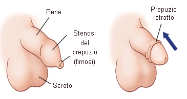 La patologia del frenulo breve